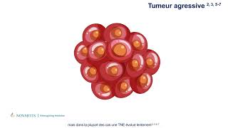 Les tumeurs neuroendocrines TNE  Qu’estce que c’est et quels sont les symptômes [upl. by Asirap]