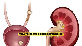 Naturheilmittel gegen Nierensteine [upl. by Eniamreg]