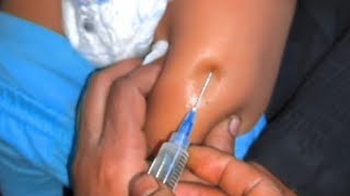 How to give an im Intramuscular injection in the buttocks [upl. by Deryl]