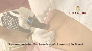 Recommendation For Stretch mark Removal  Dr Nitesh Lamoria  Purple Heron Hospital [upl. by Anairo]