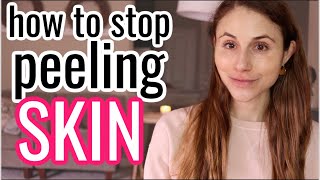 How to STOP PEELING SKIN Dr Dray [upl. by Alraep]