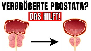 Der wichtigste Nährstoff um deine Prostata zu verkleinern [upl. by Estell]