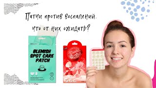 Про патчи против воспалений 2 видов Elizavecca и Lättcare Сравним их между собой [upl. by Habeh]