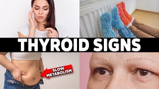 HYPOTHYROIDISM Don’t Ignore These 7 Early Warning Signs [upl. by Aztilem347]