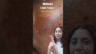 Melasma treatment  3 Best Product Recommended youtubeshorts melasmatreatment [upl. by Mihcaoj]