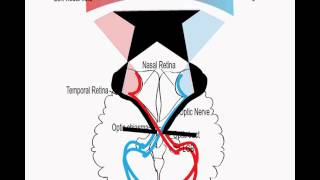 Visual pathway and visual field defects [upl. by Sitarski]