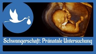 Schwangerschaft Pränatale Untersuchung [upl. by Annaujat347]