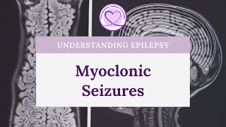 What are Myoclonic Seizures [upl. by Anael]