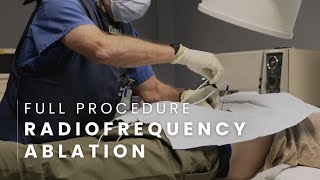 Radiofrequency Ablation Full Procedure  Lumbar [upl. by Kimmie]