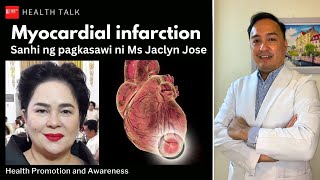 Myocardial infarction Sanhi ng pagkasawi ni Ms Jaclyn Jose [upl. by Trilbie]