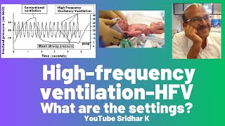 High frequency ventilation l Settings on HFV [upl. by Tigdirb]