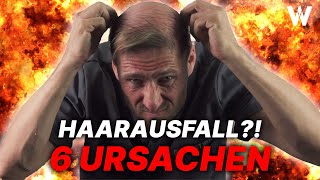 Haarausfall Die 6 häufigsten Ursachen für weniger Haare auf dem Kopf Top Tipps für volleres Haar [upl. by Atirak]