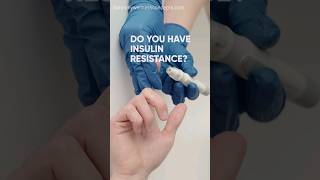 How to check your insulinresistance  functionalmedicine diabetesreversal [upl. by Aihsemat]