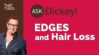 Edges and Hair Loss PostPregnancy or Menopause [upl. by Willett]