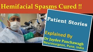 ‘Hemifacial spasms Cured’  Patient Stories explained by Dr Jaydev Panchawaghहेमिफेशियल स्पास्म [upl. by Booze]