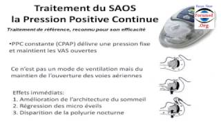 CPAP La ventilation en pression positive continue ventilation mecanique non invasive [upl. by Rhys861]