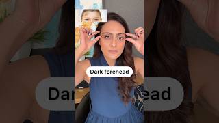 Dark forehead  How to improve  creams to use [upl. by Alam888]