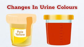 Colour Of Your Urine Says About Your Health bloodinurine [upl. by Cherri599]