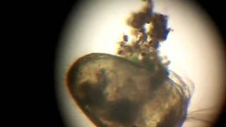 Crazy Ostracod Feeding [upl. by Margy]