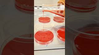 Blood Agar Plates culture microbiology agar [upl. by Aerdnaxela]