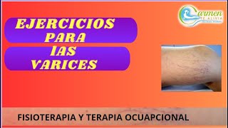 EJERCICIOS PARA LAS VARICES [upl. by Faxon611]