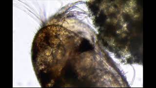 MICROSCOPY  Ostracod [upl. by Tteragram]