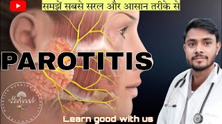 Parotitis  parotitis in hindi  paroted gland swelling  paroted gland or salivary gland infection [upl. by Elocim870]