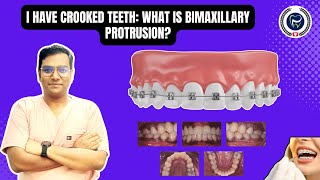 Dr Rudra Mohan  I Have Crooked Teeth What is Bimaxillary Protrusion Understand Treatment Options [upl. by Neik]