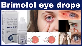 Brimolol eye drops uses in hindi  Timolol 5 mg  Brimonidine 15 mg benefits Side Effects [upl. by Karil]