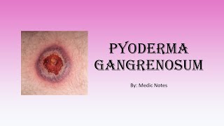 Pyoderma gangrenosum  causes pathophysiology sign value [upl. by Sundstrom]