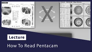 How To Read Pentacam [upl. by Fairweather867]