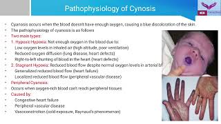 General Examination Cyanosis  Recognizing the Blue Tint  A Guide to Clinical Examination [upl. by Nattirb]