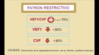 Interpretación básica de espirometría [upl. by Darom]