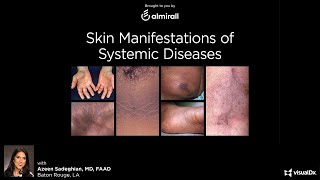 Skin Manifestations of Systemic Disease  November 5 2020 [upl. by Moulton]