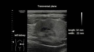 Chronic renal failure in a cat [upl. by Odicalp]