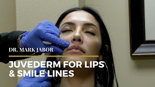 Juvederm Lips amp Smile Lines  Dr Mark Jabor [upl. by Mihe]