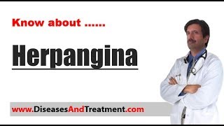 Herpangina  Causes Diagnosis Symptoms Treatment [upl. by Alyosha]