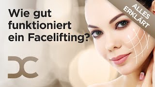 Facelifting amp Halsstraffung Sind natürliche Ergebnisse möglich  Dorow Clinic [upl. by Zanas76]