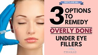 Options to Remove Excess Filler Placement and Treatments to Improve Under Eye Area [upl. by Walliw]