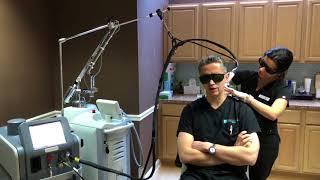 Male Laser Hair Removal with Candela GentleMax Pro [upl. by Dunkin538]