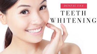 Teeth Whitening Home Remedies [upl. by Lebar]