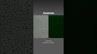 Apoptosis Timelapse video of apoptosis in HeLa cells BrightfieldampFluorescence Curiosis shorts [upl. by Micky]