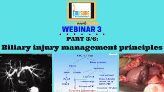 Biliary injury management  Principles  Dr Prasad Wagle  Safe laparoscopic cholecystectomy [upl. by Jennica]