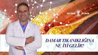 Damar Tıkanıklığına Ne İyi Gelir [upl. by Arihs]