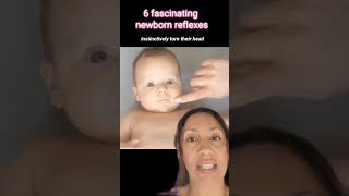 6 fascinating newborn reflexes [upl. by Sihon145]