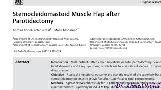 Sternocleidomastoid Muscle Flap after Parotidectomy [upl. by Naloj957]