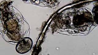 Rotifers under microscope [upl. by Huston]