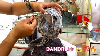 Attractive Dandruff Razor head shaved  dandruff removal bald head😱😭😳🇮🇳 [upl. by Ynar417]