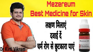 किस्सा क्लीनिक का  Mezereum  Kye Symptom  Fungal Infections  Eczema  Seborrheic dermatitis [upl. by Aiyotal239]