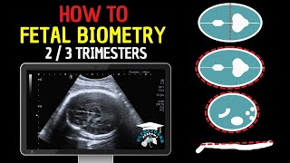 How to Perform Fetal Biometry in the Second and Third Trimesters  Practical Guide [upl. by Murdocca]